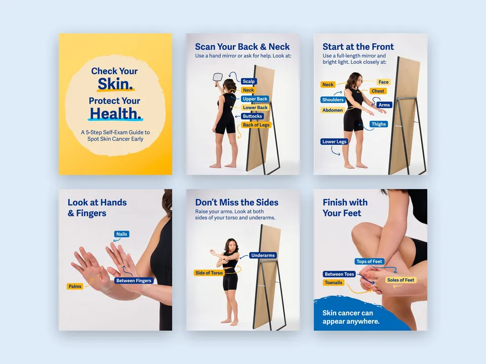 All six Check Your Skin carousel slides